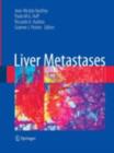 Liver Metastases - eBook
