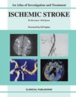 Ischemic Stroke : An Atlas of Investigation and Diagnosis - Book