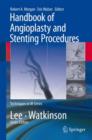 Handbook of Angioplasty and Stenting Procedures - Book