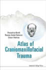 Atlas Of Craniomaxillofacial Trauma - Book