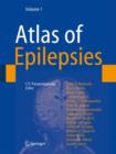 Atlas of Epilepsies - eBook