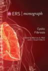 Cystic Fibrosis - eBook