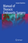 Manual of Thoracic Endoaortic Surgery - eBook