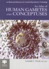 An Atlas of Human Gametes and Conceptuses : An Illustrated Reference for Assisted Reproductive Technology - Book