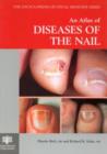 An Atlas of Diseases of the Nail - Book