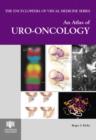 An Atlas of Uro-oncology - Book