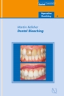 Dental Bleaching - eBook
