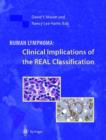 Human Lymphoma: Clinical Implications of the Real Classification - Book