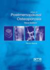 Atlas of Postmenopausal Osteoporosis : Third Edition - Book