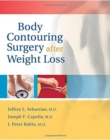 Body Contouring Surgery After Weight Loss - Book