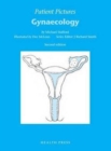 Patient Pictures: Gynaecology : Illustrated by Dee McLean. - Book