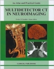 Multidetector CT in Neuroimaging - Book