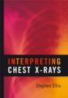 Interpreting Chest X-Rays - Book