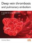 Deep Vein Thrombosis and Pulmonary Embolism: A Guide for Practitioners - Book