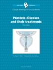 Patient Pictures: Prostate diseases and their treatments : Clinical drawings for your patients. - Book