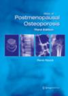 Atlas of Postmenopausal Osteoporosis : Third Edition - eBook