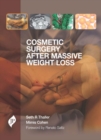 Cosmetic Surgery after Massive Weight Loss - Book