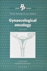 Patient Pictures: Gynaecological oncology : Clinical drawings for your patients Illustrated by Dee McLean. - Book