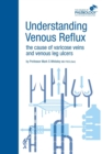 Understanding Venous Reflux the Cause of Varicose Veins and Venous Leg Ulcers - Book