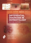Differential Diagnosis in Dermatology - Book