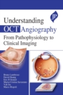 Understanding OCT Angiography : From Pathophysiology to Clinical Imaging - Book