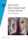 Fast Facts: Non-Small-Cell Lung Cancer - Book