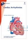 Fast Facts: Cardiac Arrhythmias - Book