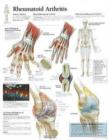 Rheumatoid Arthritis Paper Poster - Book