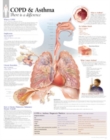 COPD & Asthma Laminated Poster - Book