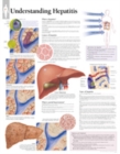Understanding Hepatitis Paper Poster - Book