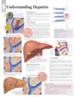 Understanding Hepatitis Laminated Poster - Book