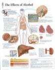 Effects of Alcohol Laminated Poster - Book