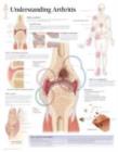 Understanding Arthritis Laminated Poster - Book