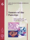 Tumors of the Pancreas - Book