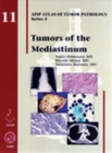 Tumors of the Mediastinum - Book