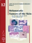 Melanocytic Tumors of the Skin - Book