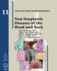 Non-Neoplastic Diseases of the Head and Neck - Book