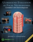Ultrasound Evaluation of Focal Neuropathies : Correlation With Electrodiagnosis - Book