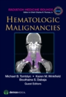 Hematologic Malignancies - Book
