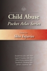 Child Abuse Pocket Atlas Series, Volume 1: Skin Injuries - Book