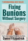 Fixing Bunions Without Surgery : How to Avoid Ending Up with Feet Like Your Mother - Book