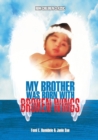My Brother Was Born With Broken Wings - Book