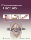 Master Techniques in Orthopaedic Surgery: Fractures - eBook