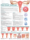 Understanding Cervical Cancer Anatomical Chart - Book