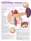 Understanding Pancreatic Cancer Anatomical Chart - Book