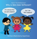 Why Is Skin Color Different? - Book