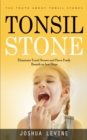 Tonsil Stones : The Truth about Tonsil Stones (Eliminate Tonsil Stones and Have Fresh Breath in Just Days!) - Book