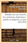 Maladies Du Cuir Chevelu. Les Syndromes Alop?ciques: Pelades Et Alop?cies En Aires - Book