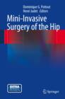 Mini-Invasive Surgery of the Hip - Book