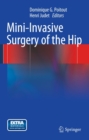 Mini-Invasive Surgery of the Hip - eBook